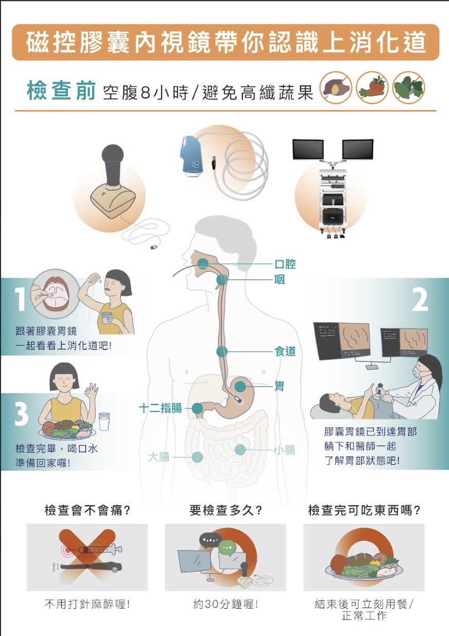 磁控膠囊胃鏡系統