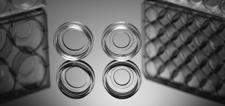 NEST玻璃底細胞培養皿、盤