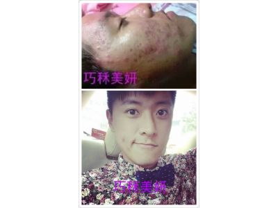 巧秝美妍館-undefined