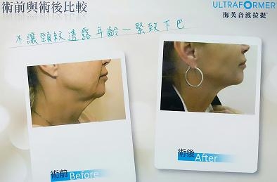 葉婦產科診所-外科