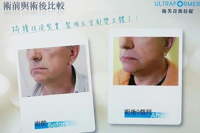 葉婦產科診所-外科