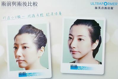 葉婦產科診所-外科