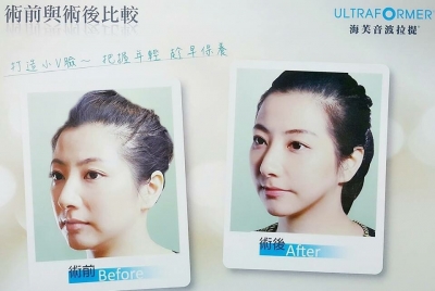 葉婦產科診所-外科