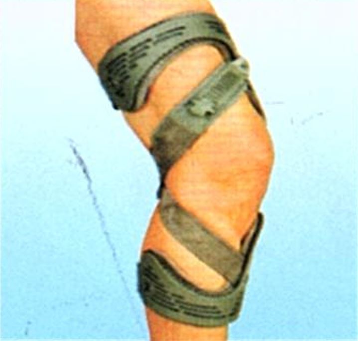 退化性關節支架