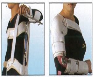 上臂外展架及肩關節骨折肱骨骨折支架