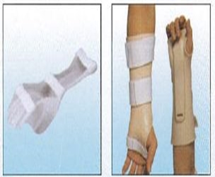 手腕骨折支架及固定支架