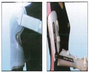 肩關節及肘關節骨折活動式支架