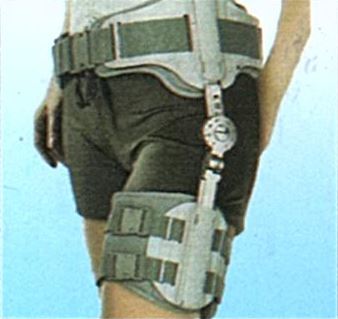 外展式髖關節支架