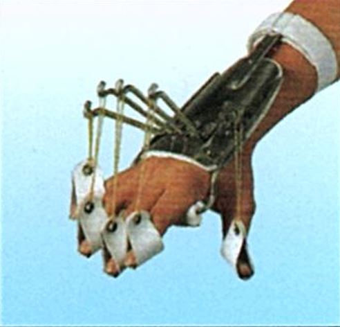 手掌神經斷裂支架