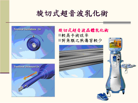 白內障超音波晶體乳化儀(Phacoemulsification)