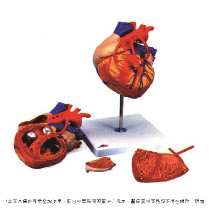 心臟附冠狀動脈模型