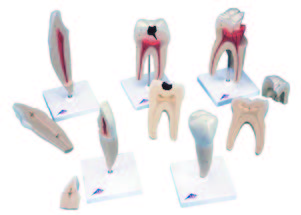 經典牙齒模型系列(5
