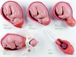 分娩各階段模型(3B)