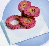 慢性阻塞肺病模型(