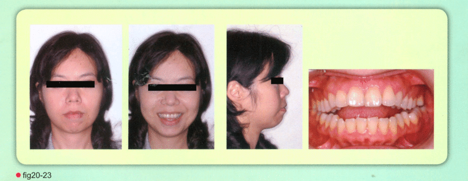 名流牙醫診所,名流牙科矯正中心,齒顎矯正,全口重建,牙醫美容,植牙,美白,貼片