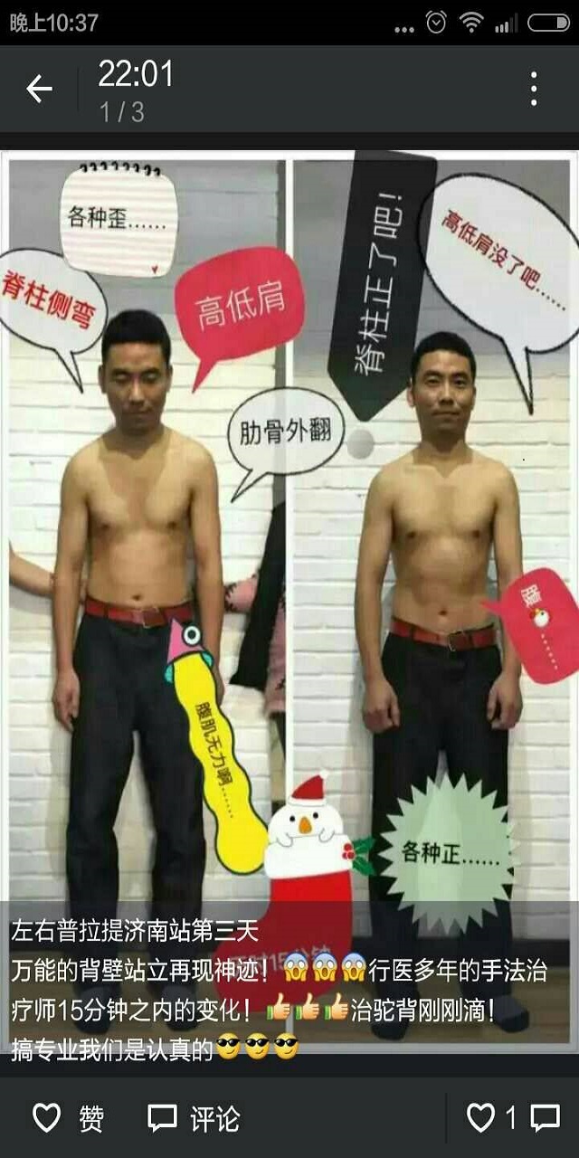 皮拉提斯+運動康復的治療調理示範