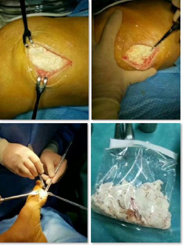 放縱自己的慾望，湖吃海喝的結果