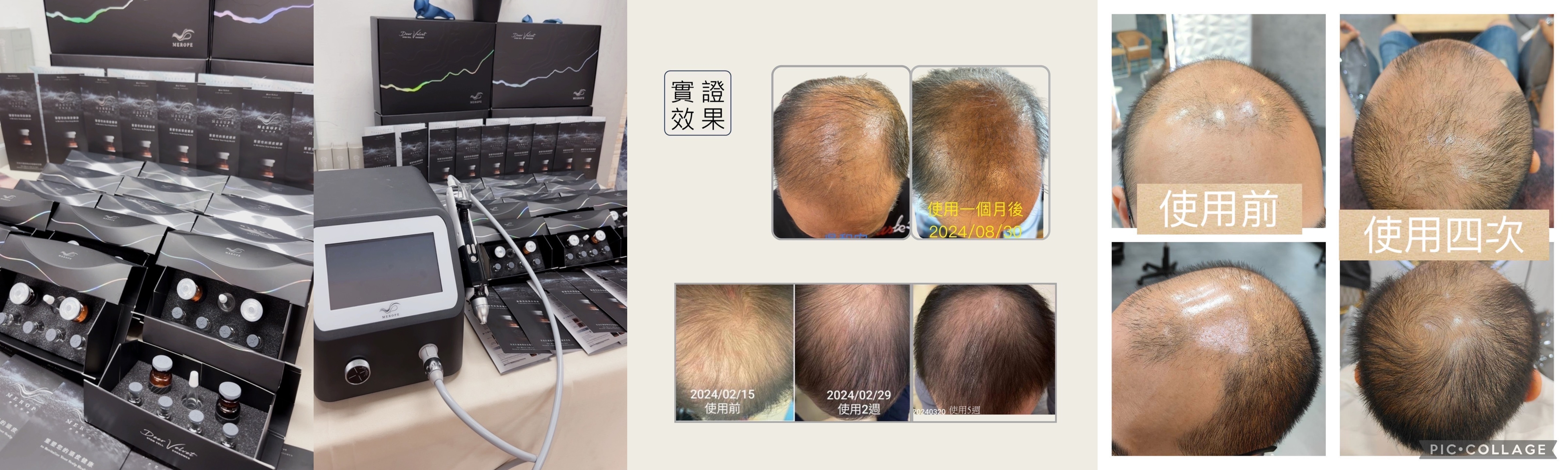 髮都Fadu hair salon 獨家引進「鹿茸外泌體」生髮技術~前30名諮詢者，即享掉髮救星優惠方案
